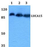 RBM5 Antibody in Western Blot (WB)