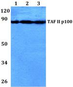 TAF5 Antibody in Western Blot (WB)