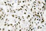 VPS72 Antibody in Immunohistochemistry (Paraffin) (IHC (P))