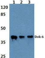 DOK6 Antibody in Western Blot (WB)