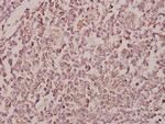 RhoBTB1/RhoBTB2 Antibody in Immunohistochemistry (Paraffin) (IHC (P))