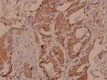 RSK4 Antibody in Immunohistochemistry (Paraffin) (IHC (P))