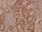 RSK4 Polyclonal Antibody