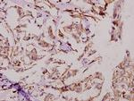 DATF1 Polyclonal Antibody