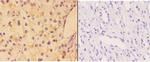 AKAP13 Polyclonal Antibody