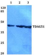 PHLDA1 Polyclonal Antibody