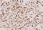 TACC3 Polyclonal Antibody