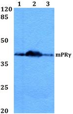 mPR gamma Antibody in Western Blot (WB)
