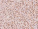 HOXD12 Polyclonal Antibody