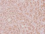 HOXD12 Antibody in Immunohistochemistry (Paraffin) (IHC (P))