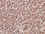 SRSF4 Polyclonal Antibody
