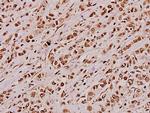 JIP3 Polyclonal Antibody