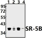 HTR5B Polyclonal Antibody