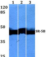 HTR5B Antibody in Western Blot (WB)