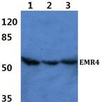 EMR4 Antibody in Western Blot (WB)