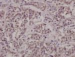CTPS Polyclonal Antibody