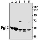 FGL2 Polyclonal Antibody