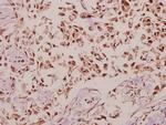 DNAJB4 Polyclonal Antibody