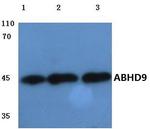 ABHD9 Antibody in Western Blot (WB)
