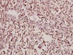 Arfaptin 1 Polyclonal Antibody