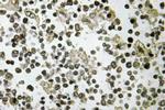 DDX55 Antibody in Immunohistochemistry (Paraffin) (IHC (P))
