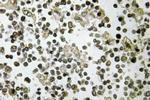 DDX55 Antibody in Immunohistochemistry (Paraffin) (IHC (P))