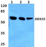 DDX55 Antibody in Western Blot (WB)
