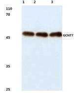 GCNT7 Polyclonal Antibody