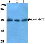 B4GALT3 Antibody in Western Blot (WB)