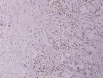 BRP44L Antibody in Immunohistochemistry (Paraffin) (IHC (P))