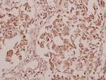 CEP135 Polyclonal Antibody