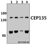 CEP135 Antibody in Western Blot (WB)