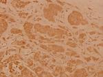 Cerebral Protein 1 Polyclonal Antibody