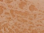Cerebral Protein 1 Antibody in Immunohistochemistry (Paraffin) (IHC (P))