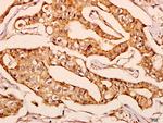 GNPAT Polyclonal Antibody
