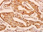 GNPAT Antibody in Immunohistochemistry (Paraffin) (IHC (P))