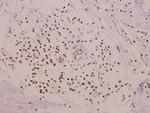 RRAD Antibody in Immunohistochemistry (Paraffin) (IHC (P))