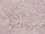 RRAD Polyclonal Antibody