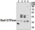 RRAD Antibody in Western Blot (WB)
