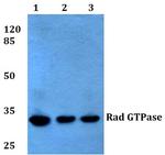 RRAD Antibody in Western Blot (WB)