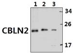 Cerebellin 2 Polyclonal Antibody