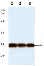 Cerebellin 2 Antibody in Western Blot (WB)
