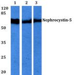 IQCB1 Antibody in Western Blot (WB)