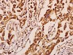 NEURL1 Polyclonal Antibody