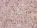 POM121 Polyclonal Antibody