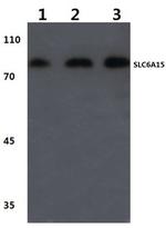 SLC6A15 Polyclonal Antibody