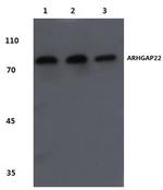 ARHGAP22 Polyclonal Antibody