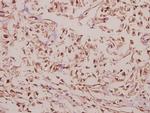 ARRDC4 Polyclonal Antibody