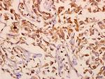 mGluR2/mGluR3 Polyclonal Antibody