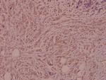 IL4R Polyclonal Antibody